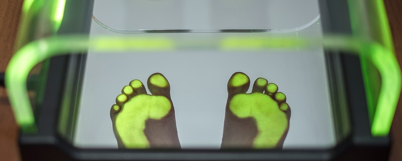 shockwave-therapy-foot-and-ankle-clinic